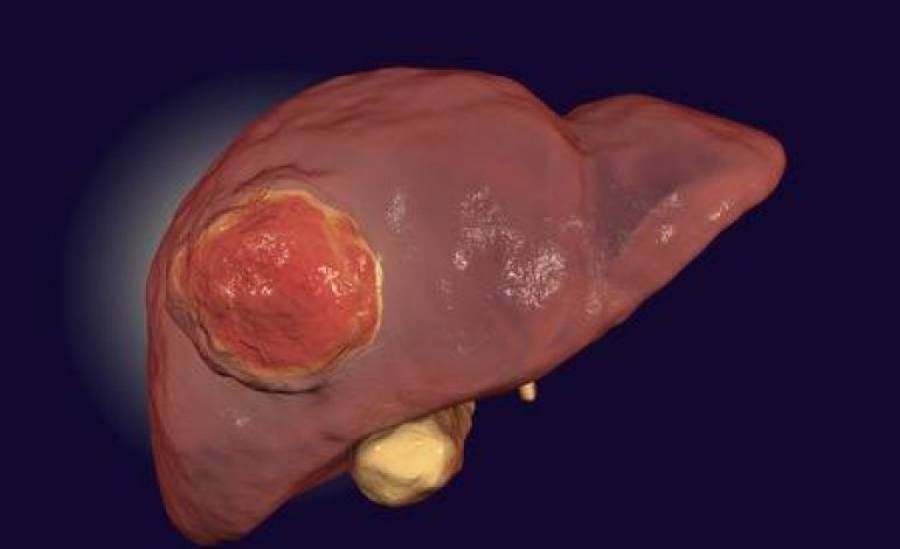 &Pi;&rho;&omega;&tau;&omicron;&pi;&alpha;&theta;ή&sigmaf; &kappa;&alpha;&rho;&kappa;ί&nu;&omicron;&sigmaf; &tau;&omicron;&upsilon; ή&pi;&alpha;&tau;&omicron;&sigmaf;