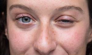 &Omicron; &sigma;&upsilon;&nu;&alpha;&sigma;&pi;&iota;&sigma;&mu;ό&sigmaf; All United for MG &epsilon;&gamma;&kappa;&alpha;&iota;&nu;&iota;ά&zeta;&epsilon;&iota; &tau;&eta;&nu; &Epsilon;&upsilon;&rho;&omega;&pi;&alpha;ϊ&kappa;ή &Eta;&mu;έ&rho;&alpha; M&upsilon;&alpha;&sigma;&theta;έ&nu;&epsilon;&iota;&alpha;&sigmaf; Gravis &sigma;&tau;&iota;&sigmaf; 2 &Iota;&omicron;&upsilon;&nu;ί&omicron;&upsilon; 2023