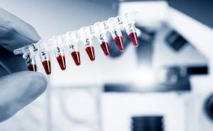 Θεράπευσαν την ωοθηκική ανεπάρκεια με βλαστοκύτταρα!